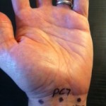 Superior Wrist Points