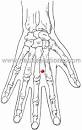 Acupuncture for Post Traumatic Stress and Traumatic Brain Injury